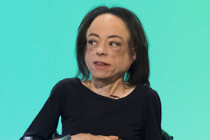 Liz Carr face